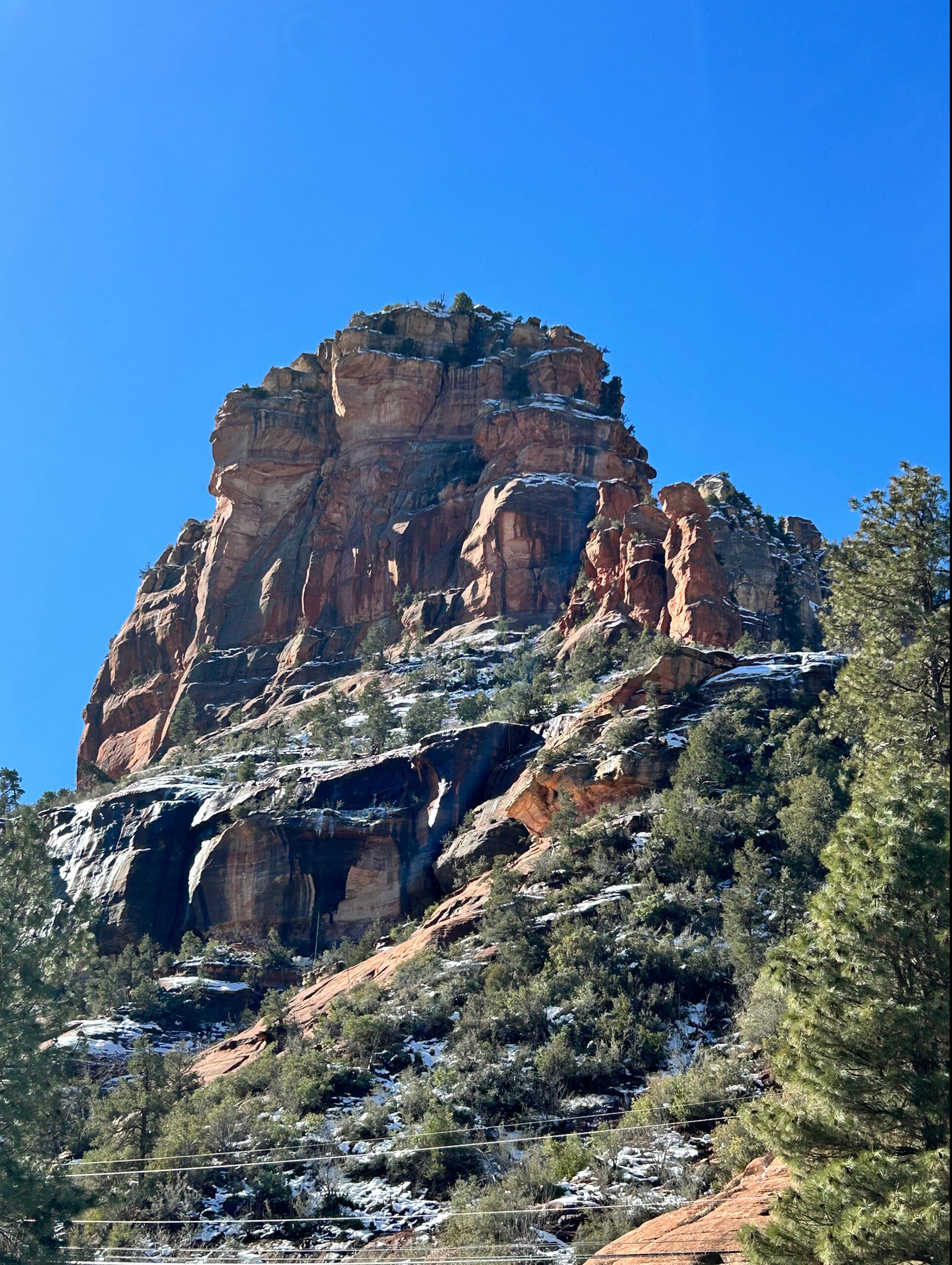 結婚前にはお股のケア